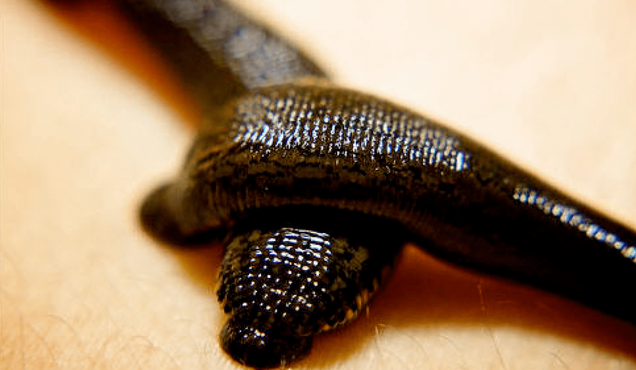Leeches to treat prostatitis